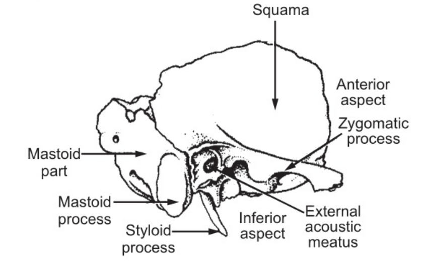 The Temporal Bone (Lateral View)