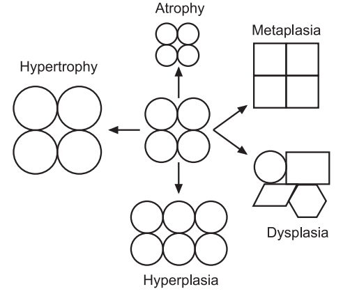 Morphological changes after cell injury
