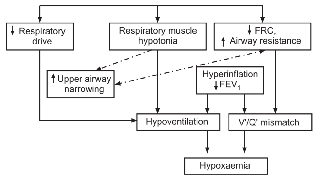 Pathophysiology of respiratory failure 